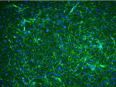 iPSC-derived-EC-from-iPSC-CD144